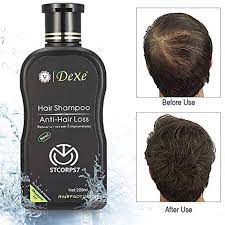 It has been tested and proven to reduce hair loss by up to 46% while increasing hair growth exponentially. Amazon Com Anti Hair Loss Shampoo Zhengpin Hair Growth Serum Hair Care Product Oil Control Anti Dandruff Relieve Head Itching Fit For Men And Women 200ml Beauty