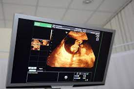 Hamil 9 bulan 10 hari = 40 minggu. Hamil 2 Bulan Dari Embrio Menjadi Janin Alodokter