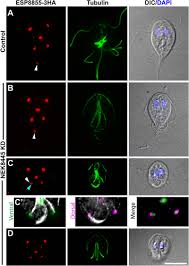 This user hasn't answered any questions yet. Nek8445 A Protein Kinase Required For Microtubule Regulation And Cytokinesis In Giardia Lamblia Molecular Biology Of The Cell