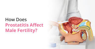 Image result for Prostatitis