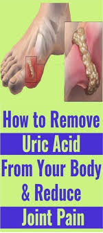 Pin On Health Remedies