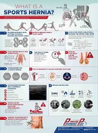 I was diagnosed in april2019, and had my first surgery on 5/6 (opensurgery), with a second one 10 days later due to an anastomotic leak. Pin On Stretches
