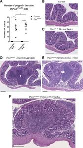 How do you use the month calculator? Pten Dfoxl1d Mice Develop Spontaneous Polyps In Their Colon By 75 Days Download Scientific Diagram