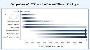 Liver function tests are blood tests that measure different enzymes, proteins, and other substances made by the liver. Interpretation Of Lfts Liver Function Tests Youtube