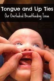Tongue Tied And Lip Tied Baby The Realistic Mama Tongue Tie Baby Breastfeeding Breastfeeding