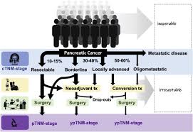 We did not find results for: Refined Tnm Staging For Pancreatic Adenocarcinoma Real Progress Or Much Ado About Nothing Sciencedirect