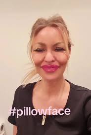 Who knows someone like this?🙋‍♀️ 'PillowFace' syndrome will never be ok as  long as I live! 🤣 DOUBLE tap if you can relate! . . . #aesthetics  #aestheticstraining #aestheticstrainingacademy ...