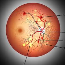 Do not rub, rinse, apply pressure, or remove any object stuck in the eye. Local Optometrists In Fruit Cove Florida