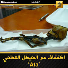 أظهر باحثون من كلية الطب بجامعة ستانفورد أن هناك هيكلا عظميا بشريا غريبا كان يشاع في السابق أنه يمتلك أصولا من خارج الأرض قد حصل على فحص جي Pocket Knife Knife