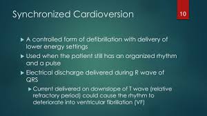 Image result for Synchronized Cardioversion
