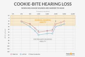 Image result for Audiogram