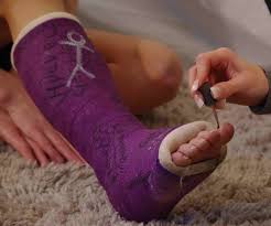 cast and toes おしゃれまとめの人気アイデア pinterest cool cast