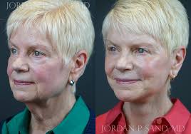 Jordan P. Sand, M.D., F.A.C.S.