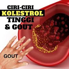 Waxy steroid) yang ditemukan pada membran sel dan disirkulasikan dalam plasma darah. Ciri Ciri Dan Tanda Gejala Awal Kolesterol Tinggi Clear Herbs