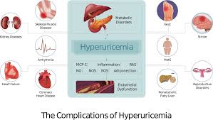 Image result for Hyperuricemia