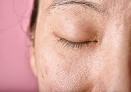 Lý giải tầm quan trọng của việc chống lão hóa tuổi 30 – Dr. Baumann VN