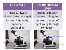 You can never get an image that is high contrast, bright and large. What Is The Function Of The Iris Diaphragm Lever