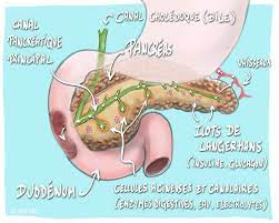 Initially, pancreatic cancer tends to be silent and as pancreatic cancer blocks duct that releases bile into the intestine (common bile duct), the in general, symptoms appear earlier from cancers in the head of the pancreas, compared to those in. Cancer Du Pancreas Snfge Org Societe Savante Medicale Francaise D Hepato Gastroenterologie Et D Oncologie Digestive
