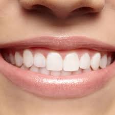We did not find results for: The Real Secret Behind Fancy Teeth
