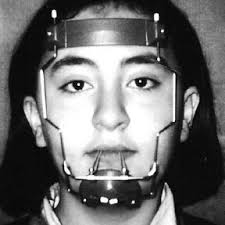 Bone Morphologic Features and Implant Placement Torque According to...