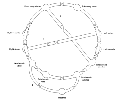 Image result for Delayed Transition from Fetal Circulation