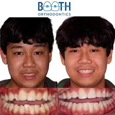 Booth Orthodontics (@boothorthodontics) · Homer Glen, IL