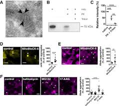 Последние твиты от dave marcus (@davemarcus). Intramitochondrial Proteostasis Is Directly Coupled To A Synuclein And Amyloid B1 42 Pathologies Journal Of Biological Chemistry
