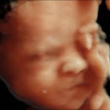 Girls softball leagues or activities in our area?