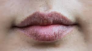 Sering merokok membuat bibir hitam? Doktor Ini Jelaskan Sebab Bibir Jadi Gelap Salah Satunya Tabiat Gigit Bibir Hijabista