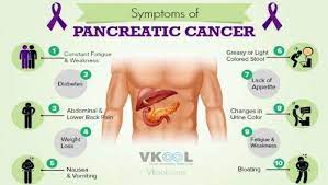 Pancreatic cancer fatty stool picture. Pancreatic Cancer What Are The Symptoms And Signs Of Pancreatic Cancer Alumniyat