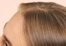 Hair thinning can be a miserable occurrence at any age, but experiencing it in as early as your 20s can leave you devastated. How To Help Combat Female Hair Loss At Length By Prose Hair