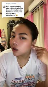 Understanding Bells Palsy: A Personal Journey