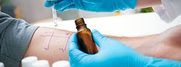 Allergy Quiz: Symptoms, Home Remedies & Food Allergies