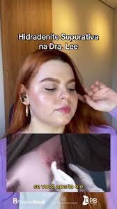 Necrobiosislipoidicadiabeticorum