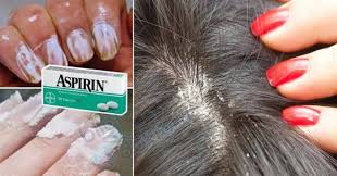 2 Adet Aspirini Eritin Ve Tip Dunyasi Bu Olayi Konusuyor Dogal Sac Bakimi Beyaz Sac Saglikli Sac