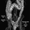 It is a painful chronic disease that is estimated to affect 10% of women of all ages and backgrounds during their reproductive years. Https Encrypted Tbn0 Gstatic Com Images Q Tbn And9gcs7wdbjb5 T8rurbwouybe8kg4xbskg6crpez88ghs Usqp Cau