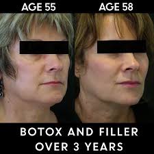 Also, put a little more emphasis on enhancing your eyes. My Top Five Treatments For New Zealand Women S Skin