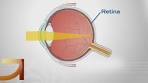 Good Question: How Do Glasses & Contacts Work?