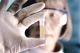 We did not find results for: 10 Ø£Ø³Ø¨Ø§Ø¨ ÙˆØ±Ø§Ø¡ Ø§ØµÙØ±Ø§Ø± Ø§Ù„Ø³Ø§Ø¦Ù„ Ø§Ù„Ù…Ù†ÙˆÙŠ Ù…ØªÙ‰ ÙŠØ³ØªØ¯Ø¹ÙŠ Ø²ÙŠØ§Ø±Ø© Ø§Ù„Ø·Ø¨ÙŠØ¨ Ø§Ù„ÙƒÙˆÙ†Ø³Ù„ØªÙˆ