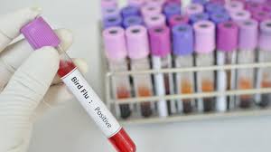 Influenza a virus subtype h10n3 is a subtype of viruses that causes influenza (flu). Zpg4bz3vhllcim