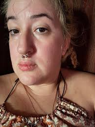 Swelling of you body legs arms , locking joints, changing of your skin  color,color of your uring changes even the number 2 color changes  ,constipation , blurry eyes version, loosing memory ,scratching