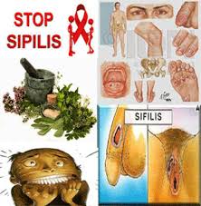 Hal ini berguna dalam demam, diaphoresis, kejang, disentri, urethrorrhea, orchiopathy, bronkitis, asma, batuk, stomatitis, penyakit sifilis, radang tenggorokan kronis, penyakit kuning dan arthritis. Klinik Sipilis Obat Antibiotik Sipilis Di Apotik