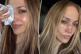 Jennifer Lopez Suffers Facial Injury During AMAs Rehearsal