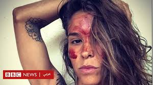 اعراض الدورة الشهرية قبل نزولها بيوم علامات الولادة النزيف المهبلي بعد سن الأربعين سن انقطاع الحيض: ÙÙØ§Ø°Ø§ ØªØ¯ÙÙ Ø¨Ø¹Ø¶ Ø§ÙÙØ³Ø§Ø¡ ÙØ¬ÙÙÙÙ Ø¨Ø¯Ù Ø§ÙØ¯ÙØ±Ø© Ø§ÙØ´ÙØ±ÙØ© Bbc News Ø¹Ø±Ø¨Ù