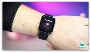 Xiaomi Mi Watch Lite Bewertung ...