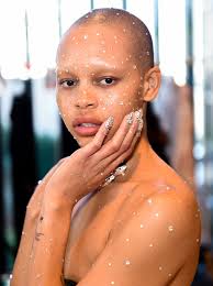 .acne is a frustrating, and sometimes, a distressing skin condition which can affect more areas of their body than just the face. How To Get Rid Of Acne Scars 15 Acne Scar Treatments Creams Serums And Products