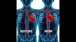 Where is the human heart located. Last Month I Felt My Heart Beating At The Center Of My Chest For The First Time In My Entire Life Retconned