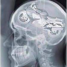 On The Brain Harley Bikes Harley Davidson Motorcycle