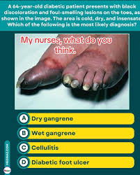 Image result for toe black diabetes