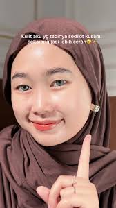 Pertanyaan Seputar Tretinoin dan Vitamin C